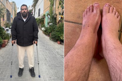 Francisco Inteño, con muletas, y su pie izquierdo, el que espera a que le amputen.