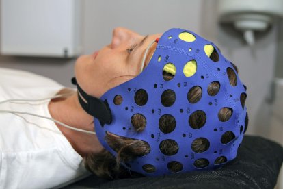 Terapia Transcraneal