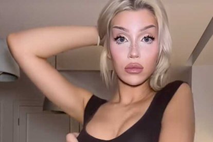 Adea, la 'influencer' francesa que se ha quitado las costillas