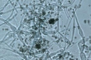Pese a sus grandes posibilidades de presente y futuro, la microbiología aún plantea algunos interrogantes en cuanto a su aplicación.
