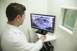 Un médico examina una radiografía.