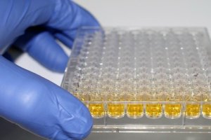 Se trata de la primera patente mundial de una molécula que protege al riñón impidiendo que se extienda el fallo renal. / Imagen de archivo