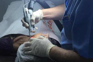 El director de la Clínica Salud y Láser, Francisco José Maldonado, aplicando el láser a una paciente en su consulta del Paseo de Almería, 46, 8º, 1.