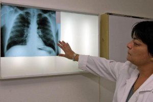 Una sanitaria observa una radiografía en un centro sanitario.