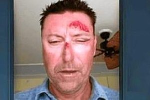 Imagen del jugador tras uno de los grandes sustos de su vida.