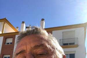 El alcalde muestra la herida que le ha producido el golpe.