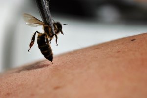 Las abejas tienen un veneno llamado apitoxina.