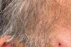 El denunciante fue herido en la cara con una barra de hierro.