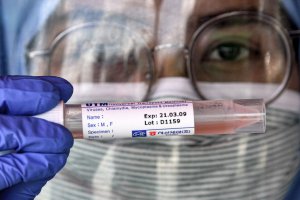 Los positivos vuelven a aumentar en Almería.