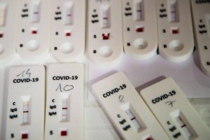 Los test han llegado a la mayoría de los clubes alemanes.