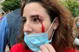 Imagen de Rocío de Meer tras el incidente en Sestao.