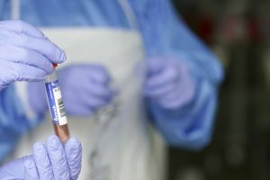 Científicos chinos han realizado una nueva estimación del período de incubación del COVID-19