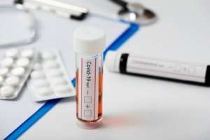 Aparece es escena una nueva prueba, los test de antígenos.