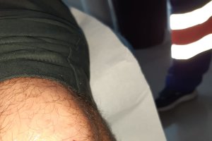 Fotografía del corte recibido en la pierna por uno de los agentes.