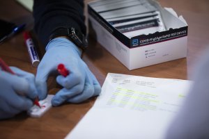 Test para la detección del coronavirus.