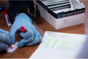 Test para la detección del coronavirus.