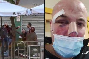 Imágenes de la agresión y de cómo ha quedado el varón que recibió la paliza. Foto de El Observador