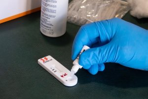 Mesa con pruebas de anticuerpos de detección de la Covid-19.