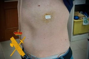 La víctima tuvo que ser atendido en el Hospital de La Inmaculada, de Huércal-Overa.