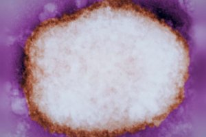 Partícula ampliada del virus de la viruela del mono.