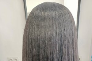 Ventajas de la nanoplastia.