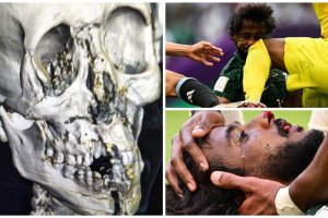 La grave lesión que sufrió el jugador de Arabia Saudí.