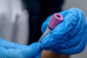 La nueva variante, detectada en Andalucía.