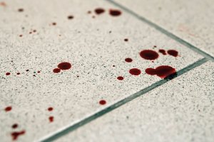 La víctima fue tiroteada por un desconocido.