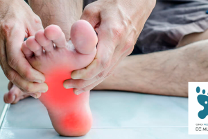 Inflamación de la fascia plantar.
