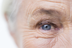 Envejecimiento de la piel