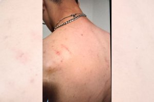 El joven presentaba lesiones en su espalda tras el suceso.