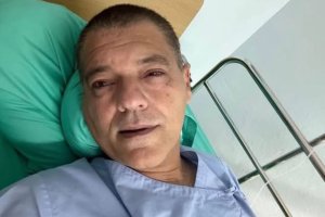 Frank Cuesta con la cara hinchada en el hospital tras el ataque de la cobra.