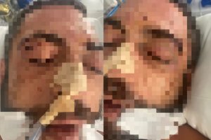 Dos de las imágenes del hostelero, compartidas por su hermano, mientras permanece en coma inducido.