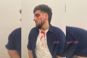 Imagen compartida por el joven tras la agresión.