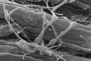 El pleno del Parlamento Europeo (PE) pidió este martes que sean más rápidos los procedimientos de aprobación y autorización de los agentes de control biológico
