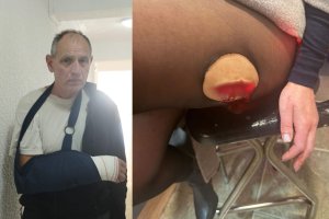 Los vecinos agredidos físicamente Iván y Anna.