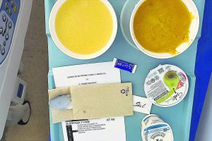Bandeja con un almuerzo en el Hospital Torrecárdenas, sin agua.