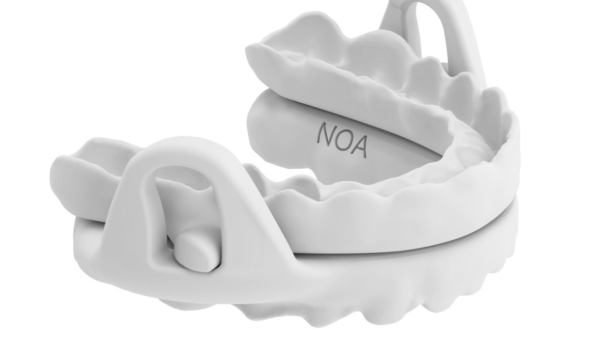 Dispositivo de avance mandibular realizado a medida, una alternativa cómoda frente a la apnea.