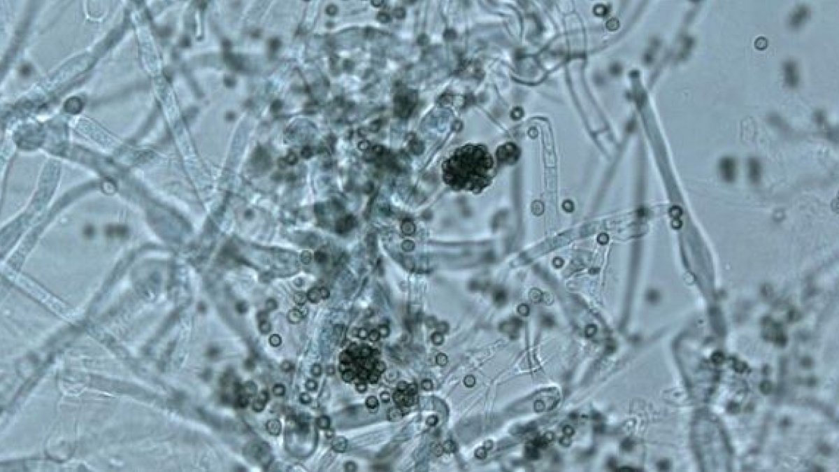 Pese a sus grandes posibilidades de presente y futuro, la microbiología aún plantea algunos interrogantes en cuanto a su aplicación.