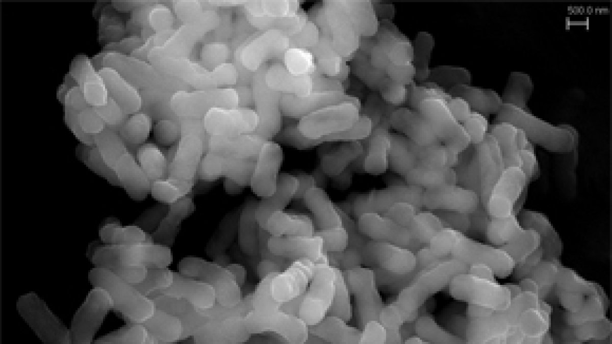 La bacteria Klebsiella sp. 3S1. Fuente: IAgua.