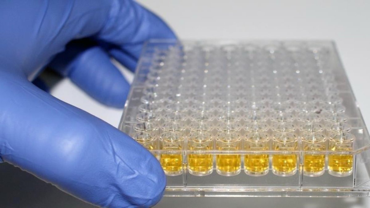 Se trata de la primera patente mundial de una molécula que protege al riñón impidiendo que se extienda el fallo renal. / Imagen de archivo