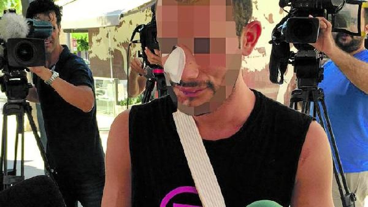 Juanjo después de ser dado de alta en el hospital.