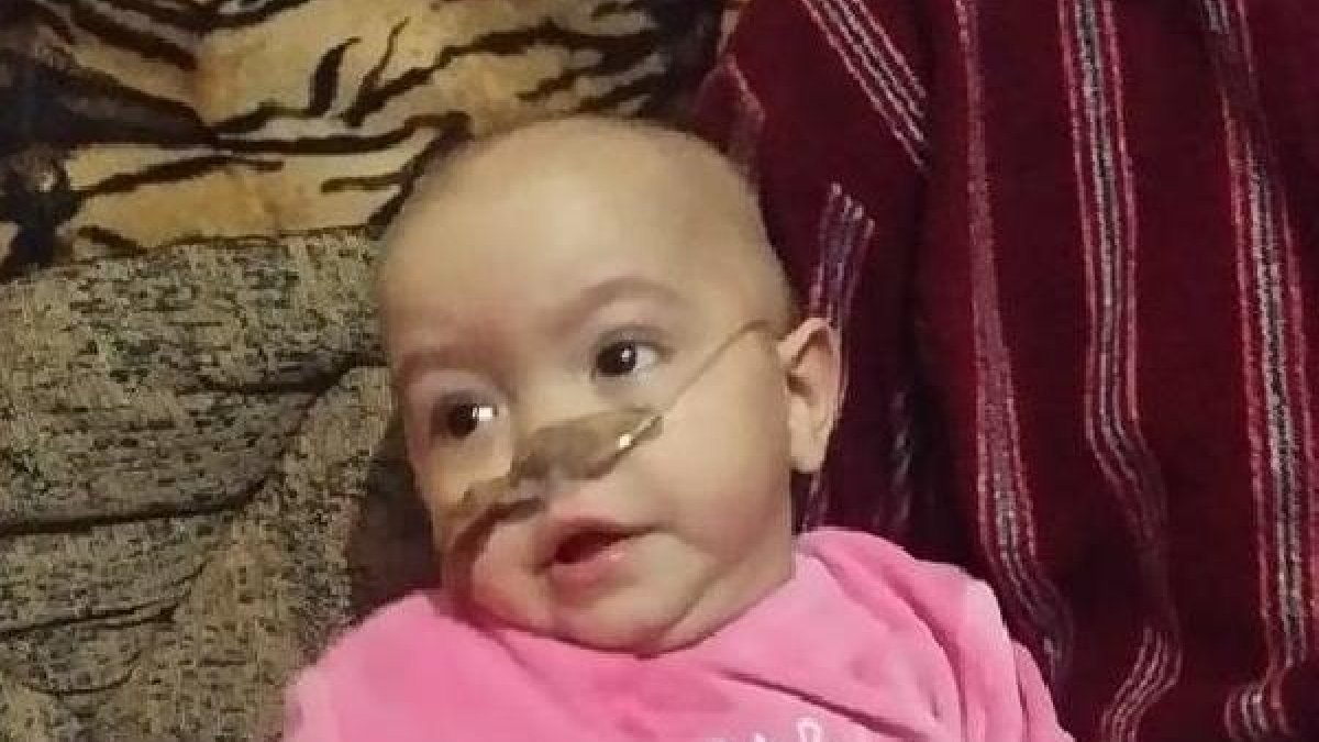 La pequeña Ángela sufre el síndrome de Niemann-Pick.