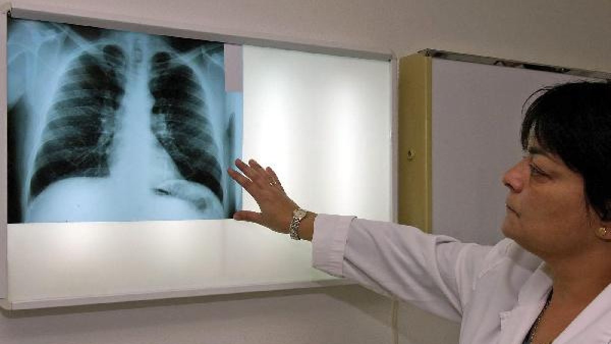 Una sanitaria observa una radiografía en un centro sanitario.