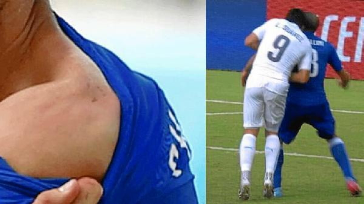 Las imágenes delatan al delantero de Uruguay.x,