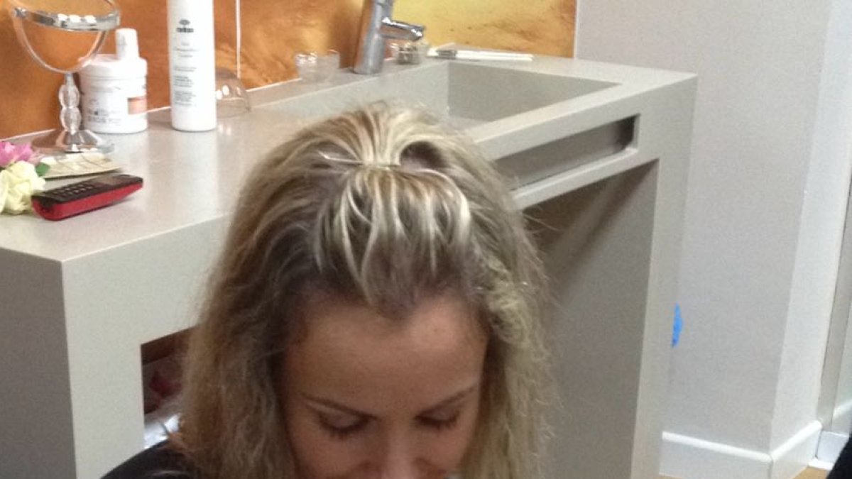 Personal médico realizando un tratamiento capilar.