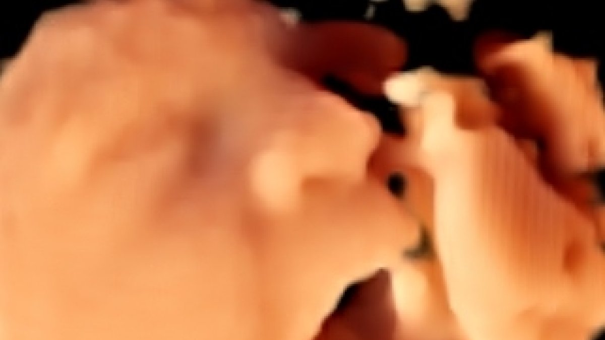 Una ecografía 4D permite ver los rasgos del bebé.