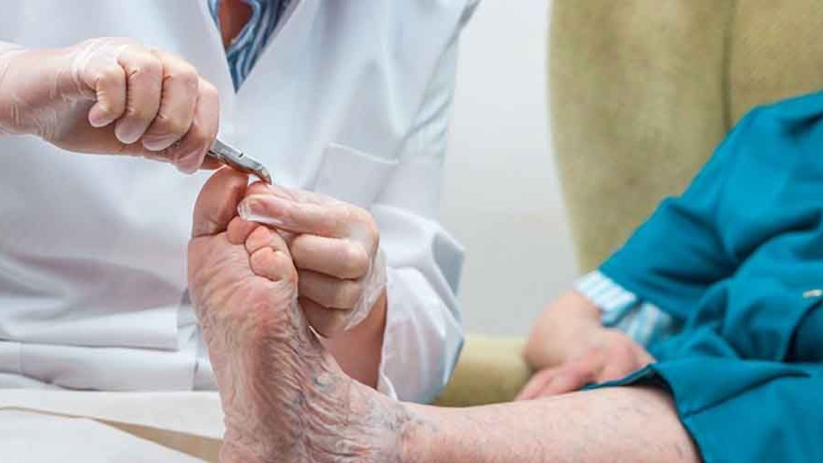 Podólogo cortándole las uñas a un anciano en una consulta.