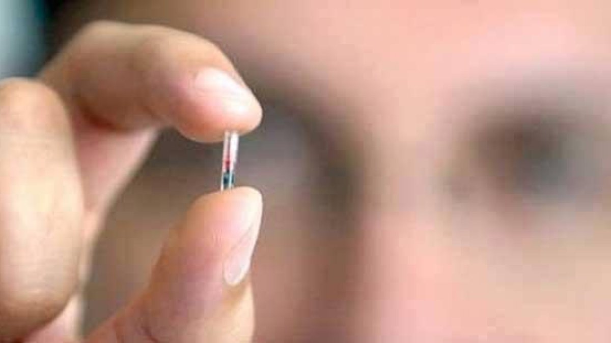 Así es un microchip común.
