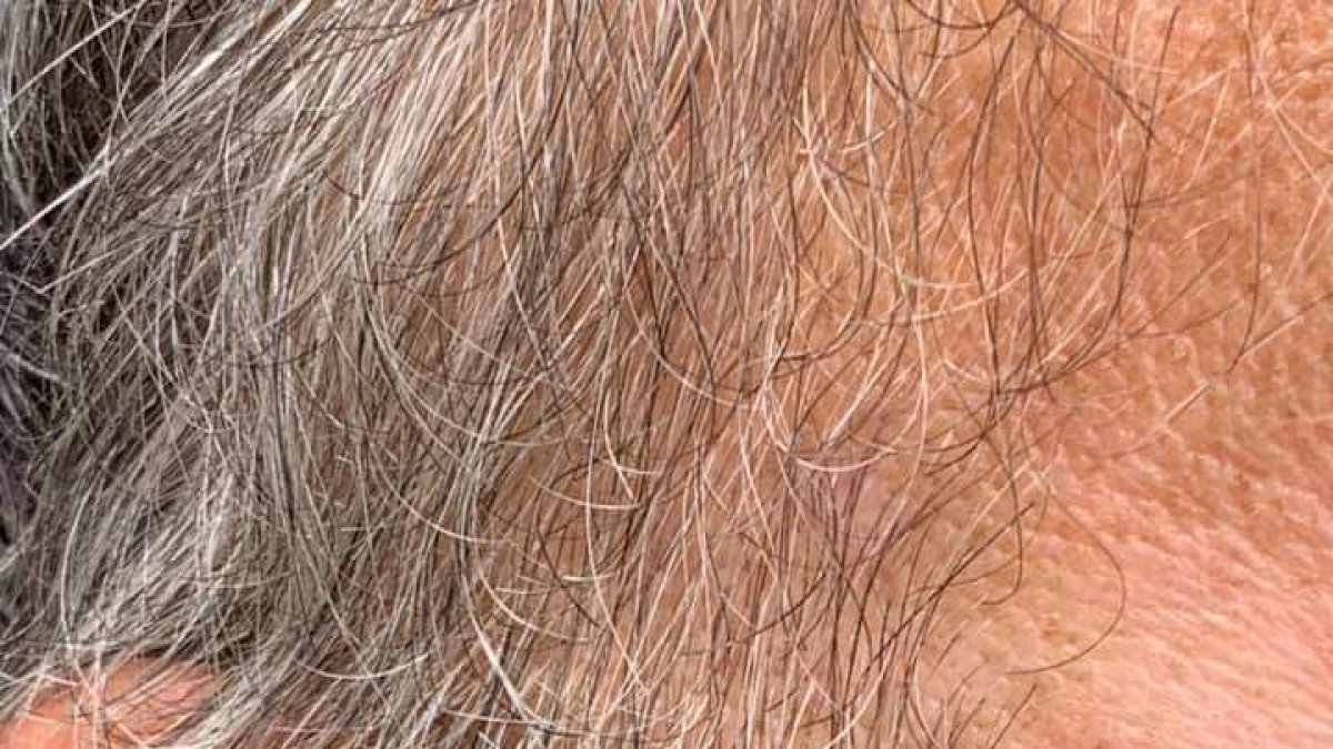 El denunciante fue herido en la cara con una barra de hierro.